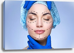 Постер Пациентка на пластической хирургии лица