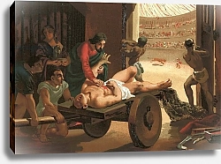 Постер Планелла Коромина Хосе Galen assisting a gladiator, wounded in the circus of Bergamo