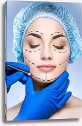 Постер Пациентка пластического хирурга
