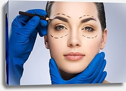Постер Хирург рисует пунктирные линии вокруг глаз
