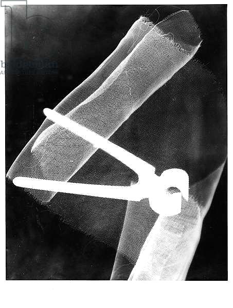 Photogram with pliers, 1920