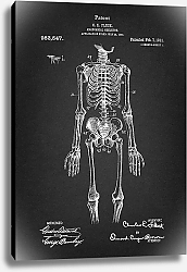 Постер Патент на анатомический скелет, 1911г