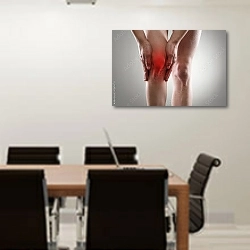 «Сухожильные проблемы на ноге женщины» в интерьере конференц-зала над столом