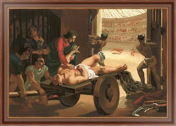 Постер Galen assisting a gladiator, wounded in the circus of Bergamo с типом исполнения На холсте в раме в багетной раме 35-M719P-83