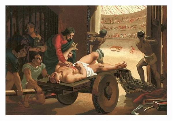 Постер Galen assisting a gladiator, wounded in the circus of Bergamo с типом исполнения На холсте в раме в багетной раме 221-03