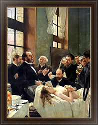 Постер Джервекс Уильям Before the Operation, or Doctor Pean teaching at Saint-Louis hospital, 1887