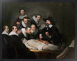 Постер Рембрандт (Rembrandt) The Anatomy Lesson of Dr. Nicolaes Tulp, 1632 5